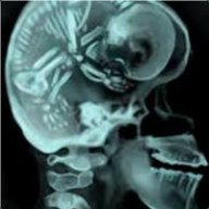 MentalFetus