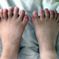 Toe Licker 221
